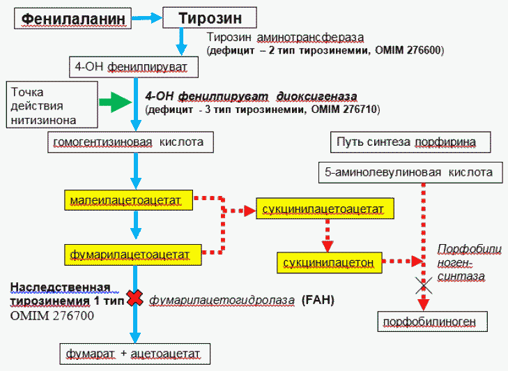 Тирозинемия у детей презентация