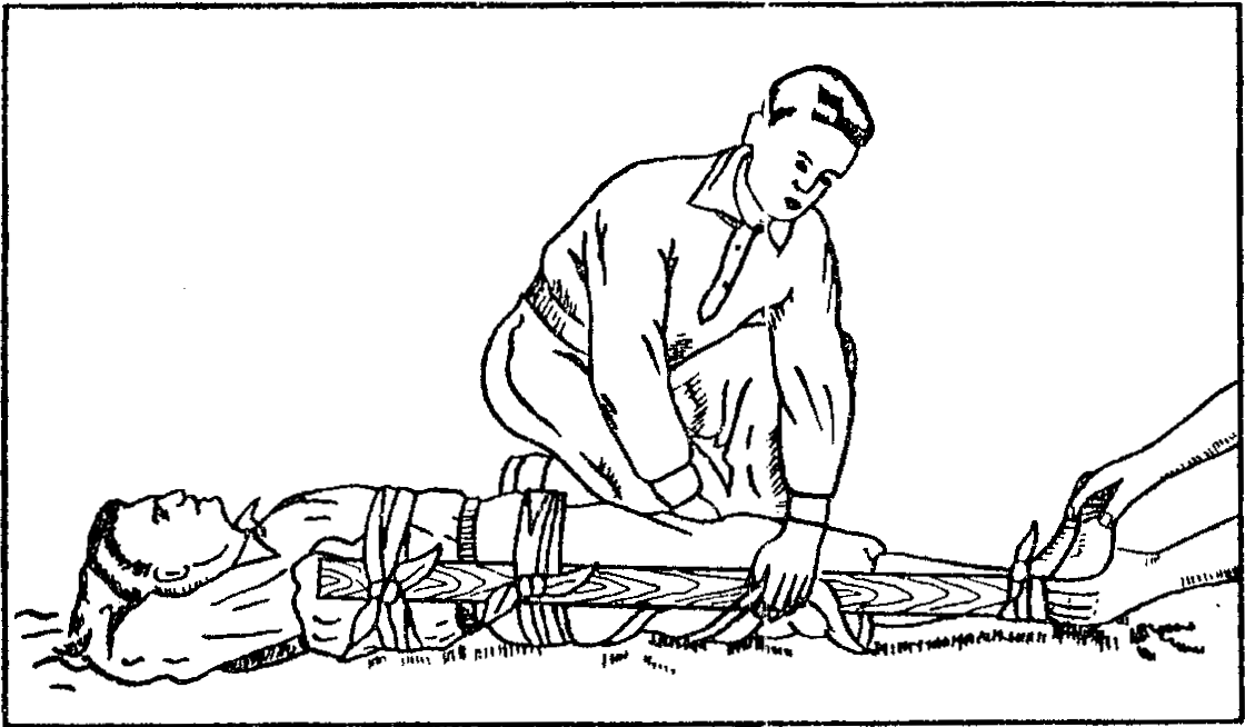 Помощь при переломе позвоночника. Повязка при переломе бедра. Перелом бедра первая помощь повязка. Повязка при переломе позвоночника. Повязка при переломе бедренной кости.