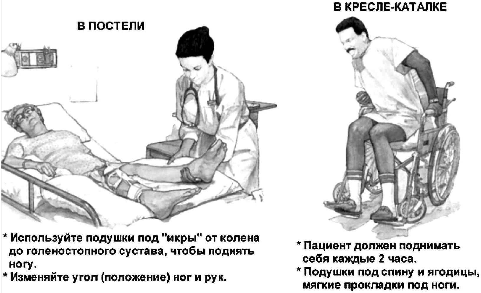 Перемещение пациента из положения сидя на стуле в положение лежа на кровати алгоритм